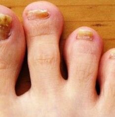 Nog's foot
