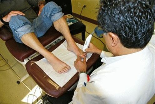 Laser nail removal