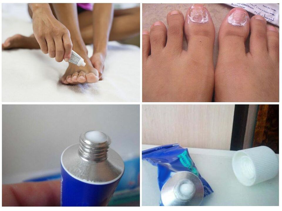 effective medicinal preparations against nail fungus
