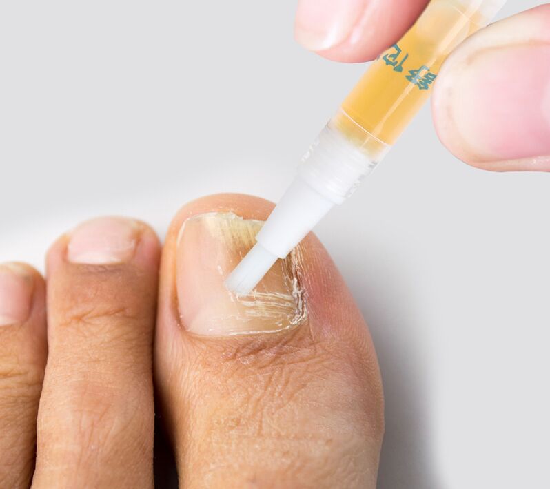 nail fungus liquid
